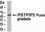 E coli-derived fusion protein as test antigen. Affinity-purified IgY dilution: 1:2000, Goat anti-IgY-HRP dilution: 1:1000. Colorimetric method for signal development.