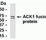 E coli-derived fusion protein as test antigen. Affinity-purified IgY dilution: 1:2000, Goat anti-IgY-HRP dilution: 1:1000. Colorimetric method for signal development.