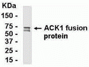 TNK2 Antibody