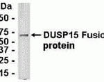 E coli-derived fusion protein as test antigen. Affinity-purified IgY dilution: 1:2000, Goat anti-IgY-HRP dilution: 1:1000. Colorimetric method for signal development.