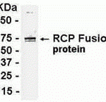 E coli-derived fusion protein as test antigen. Affinity-purified IgY dilution: 1:2000, Goat anti-IgY-HRP dilution: 1:1000. Colorimetric method for signal development.