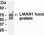E coli-derived fusion protein as test antigen. Affinity-purified IgY dilution: 1:2000, Goat anti-IgY-HRP dilution: 1:1000. Colorimetric method for signal development.