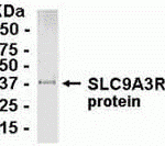 Direct Elisa Test. Protein as test antigen. Affi-pure IgY as primary antibody and Goat anti-IgY HRP as 2nd antibody. Fixed amount of antigen (5 ug/mL) and serial dilutions of antibody. <br><br>Placenta protein extract as test antigen. Affinity-purified IgY dilution: 1:500, Goat anti-IgY-HRP dilution: 1:1000. Colorimetric method for signal development.