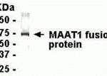 E coli-derived fusion protein as test antigen. Affinity-purified IgY dilution: 1:2000, Goat anti-IgY-HRP dilution: 1:1000. Colorimetric method for signal development.