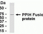E coli-derived fusion protein as test antigen. Affinity-purified IgY dilution: 1:2000, Goat anti-IgY-HRP dilution: 1:1000. Colorimetric method for signal development.