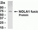 E coli-derived fusion protein as test antigen. Affinity-purified IgY dilution: 1:2000, Goat anti-IgY-HRP dilution: 1:1000. Colorimetric method for signal development.
