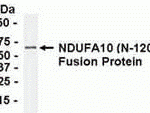 Direct Elisa Test. Protein as test antigen. Affi-pure IgY as primary antibody and Goat anti-IgY HRP as 2nd antibody. Fixed amount of antigen (5 ug/mL) and serial dilutions of antibody. <br><br>E coli-derived fusion protein as test antigen. Affinity-purified IgY dilution: 1:2000, Goat anti-IgY-HRP dilution: 1:1000. Colorimetric method for signal development.