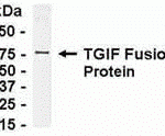 E coli-derived fusion protein as test antigen. Affinity-purified IgY dilution: 1:2000, Goat anti-IgY-HRP dilution: 1:1000. Colorimetric method for signal development.