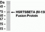 E coli-derived fusion protein as test antigen. Affinity-purified IgY dilution: 1:2000, Goat anti-IgY-HRP dilution: 1:1000. Colorimetric method for signal development.