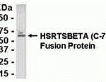 E coli-derived fusion protein as test antigen. Affinity-purified IgY dilution: 1:2000, Goat anti-IgY-HRP dilution: 1:1000. Colorimetric method for signal development.