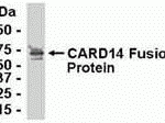 E coli-derived fusion protein as test antigen. Affinity-purified IgY dilution: 1:2000, Goat anti-IgY-HRP dilution: 1:1000. Colorimetric method for signal development.