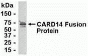 CARD14 Antibody