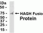 E coli-derived fusion protein as test antigen. Affinity-purified IgY dilution: 1:2000, Goat anti-IgY-HRP dilution: 1:1000. Colorimetric method for signal development.
