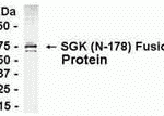 E coli-derived fusion protein as test antigen. Affinity-purified IgY dilution: 1:2000, Goat anti-IgY-HRP dilution: 1:1000. Colorimetric method for signal development.