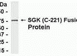 E coli-derived fusion protein as test antigen. Affinity-purified IgY dilution: 1:2000, Goat anti-IgY-HRP dilution: 1:1000. Colorimetric method for signal development.