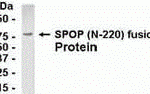 E coli-derived fusion protein as test antigen. Affinity-purified IgY dilution: 1:2000, Goat anti-IgY-HRP dilution: 1:1000. Colorimetric method for signal development.