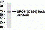 E coli-derived fusion protein as test antigen. Affinity-purified IgY dilution: 1:2000, Goat anti-IgY-HRP dilution: 1:1000. Colorimetric method for signal development.