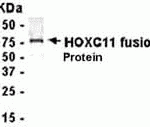E coli-derived fusion protein as test antigen. Affinity-purified IgY dilution: 1:2000, Goat anti-IgY-HRP dilution: 1:1000. Colorimetric method for signal development.