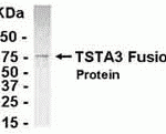 E coli-derived fusion protein as test antigen. Affinity-purified IgY dilution: 1:2000, Goat anti-IgY-HRP dilution: 1:1000. Colorimetric method for signal development.