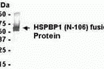E coli-derived fusion protein as test antigen. Affinity-purified IgY dilution: 1:2000, Goat anti-IgY-HRP dilution: 1:1000. Colorimetric method for signal development.