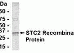 E coli-derived fusion protein as test antigen. Affinity-purified IgY dilution: 1:2000, Goat anti-IgY-HRP dilution: 1:1000. Colorimetric method for signal development.