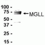 E coli-derived fusion protein as test antigen. Affinity-purified IgY dilution: 1:2000, Goat anti-IgY-HRP dilution: 1:1000. Colorimetric method for signal development.