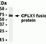 E coli-derived fusion protein as test antigen. Affinity-purified IgY dilution: 1:2000, Goat anti-IgY-HRP dilution: 1:1000. Colorimetric method for signal development.
