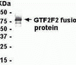 E coli-derived fusion protein as test antigen. Affinity-purified IgY dilution: 1:2000, Goat anti-IgY-HRP dilution: 1:1000. Colorimetric method for signal development.