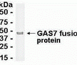 E coli-derived fusion protein as test antigen. Affinity-purified IgY dilution: 1:2000, Goat anti-IgY-HRP dilution: 1:1000. Colorimetric method for signal development.