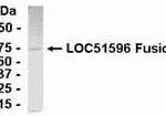E coli-derived fusion protein as test antigen. Affinity-purified IgY dilution: 1:2000, Goat anti-IgY-HRP dilution: 1:1000. Colorimetric method for signal development.