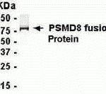 E coli-derived fusion protein as test antigen. Affinity-purified IgY dilution: 1:2000, Goat anti-IgY-HRP dilution: 1:1000. Colorimetric method for signal development.