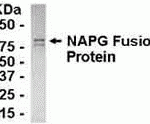 E coli-derived fusion protein as test antigen. Affinity-purified IgY dilution: 1:2000, Goat anti-IgY-HRP dilution: 1:1000. Colorimetric method for signal development.