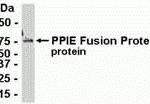 E coli-derived fusion protein as test antigen. Affinity-purified IgY dilution: 1:2000, Goat anti-IgY-HRP dilution: 1:1000. Colorimetric method for signal development.