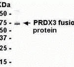 E coli-derived fusion protein as test antigen. Affi-anti-SAR1 IgY dilution: 1:2000, Goat anti-IgY-HRP dilution: 1:1000. Colorimetric method for signal development.