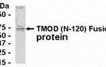 E coli-derived fusion protein as test antigen. Affinity-purified IgY dilution: 1:2000, Goat anti-IgY-HRP dilution: 1:1000. Colorimetric method for signal development.