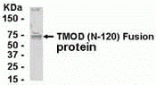TMOD1 Antibody