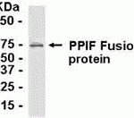 E coli-derived fusion protein as test antigen. Affinity-purified IgY dilution: 1:2000, Goat anti-IgY-HRP dilution: 1:1000. Colorimetric method for signal development.