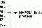 E coli-derived fusion protein as test antigen. Affinity-purified IgY dilution: 1:2000, Goat anti-IgY-HRP dilution: 1:1000. Colorimetric method for signal development.