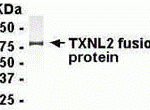 E coli-derived fusion protein as test antigen. Affinity-purified IgY dilution: 1:2000, Goat anti-IgY-HRP dilution: 1:1000. Colorimetric method for signal development.