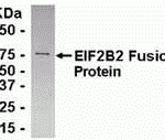 E coli-derived fusion protein as test antigen. Affinity-purified IgY dilution: 1:2000, Goat anti-IgY-HRP dilution: 1:1000. Colorimetric method for signal development.