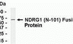 E coli-derived fusion protein as test antigen. Affinity-purified IgY dilution: 1:2000, Goat anti-IgY-HRP dilution: 1:1000. Colorimetric method for signal development.