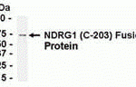 E coli-derived fusion protein as test antigen. Affinity-purified IgY dilution: 1:2000, Goat anti-IgY-HRP dilution: 1:1000. Colorimetric method for signal development.
