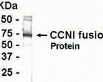 E coli-derived fusion protein as test antigen. Affinity-purified IgY dilution: 1:2000, Goat anti-IgY-HRP dilution: 1:1000. Colorimetric method for signal development.