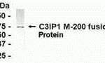 E coli-derived fusion protein as test antigen. Affi-pure IgY dilution: 1:2000, Goat anti-IgY-HRP dilution: 1:1000. Colorimetric method for signal development.