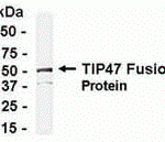 E coli-derived fusion protein as test antigen. Affinity-purified IgY dilution: 1:2000, Goat anti-IgY-HRP dilution: 1:1000. Colorimetric method for signal development.