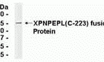 E coli-derived fusion protein as test antigen. Affinity-purified IgY dilution: 1:2000, Goat anti-IgY-HRP dilution: 1:1000. Colorimetric method for signal development.
