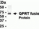 E coli-derived fusion protein as test antigen. Affinity-purified IgY dilution: 1:2000, Goat anti-IgY-HRP dilution: 1:1000. Colorimetric method for signal development.