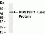 E coli-derived fusion protein as test antigen. Affinity-purified IgY dilution: 1:2000, Goat anti-IgY-HRP dilution: 1:1000. Colorimetric method for signal development.
