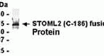 E coli-derived fusion protein as test antigen. Affinity-purified IgY dilution: 1:2000, Goat anti-IgY-HRP dilution: 1:1000. Colorimetric method for signal development.