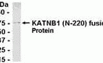 E coli-derived fusion protein as test antigen. Affinity-purified IgY dilution: 1:2000, Goat anti-IgY-HRP dilution: 1:1000. Colorimetric method for signal development.